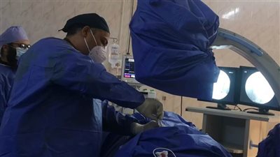 علاج حالتين بدون تدخل جراحي لمرضى آلام الفقرات والغضروف بمستشفى الزقازيق