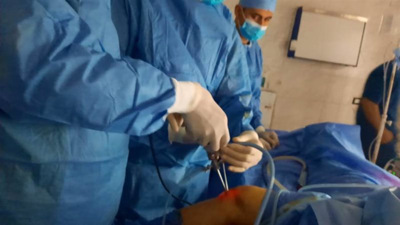 إجراء عملية منظار