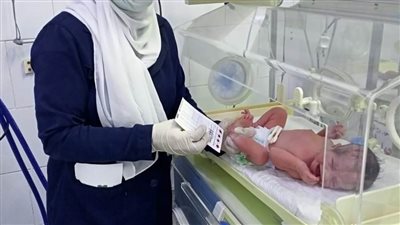 فحص 10 آلاف طفل بالمبادرة الرئاسية للكشف عن الأمراض الوراثية بالشرقية 