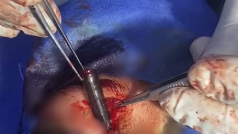 أثناء استخراج قلم