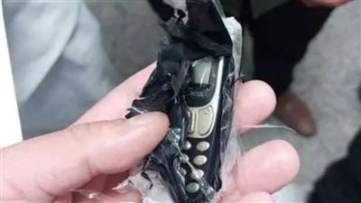 استخراج هاتف محمول من بطن شاب بمستشفى بنها الجامعي