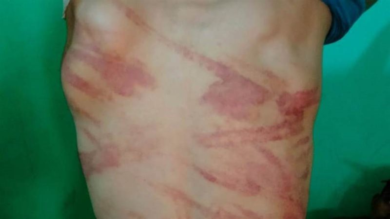 جانب من تعذيب المجنى