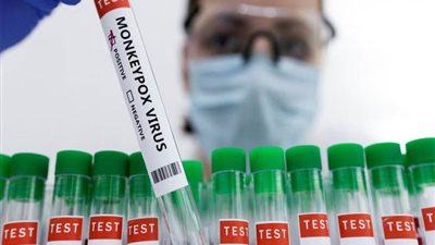 بريطانيا.. تسجيل 73 إصابة جديدة بجدري القردة