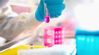  أبرز نتائج التجارب السريرية تكشف وجود عقار جديد ضد أورام سرطان المستقيم