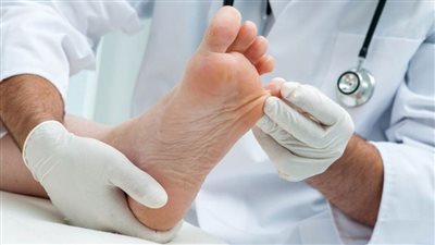 الطبيب وليد الدالي يحذر من مخاطر الإصابة بالغرغرينا لمرضى السكر فى هذه الحالة