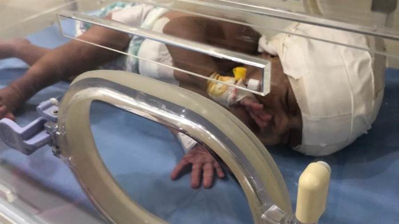 الطفلة سماح