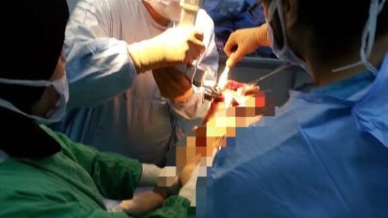 إجراء ١٠ عمليات بمستشفى