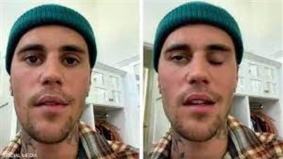 جاستن بيبر يبدأ رحلة التعافي من متلازمة 