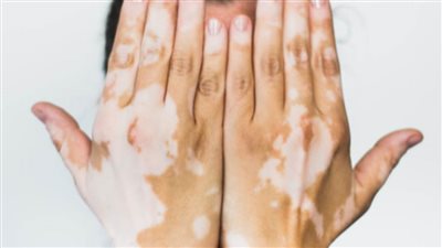 السلطات الصحية في 