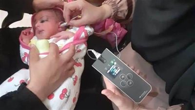 توقيع الكشف الطبي على 11 ألف طفل من حديثي الولادة بالمنيا خلال يونيو الماضي