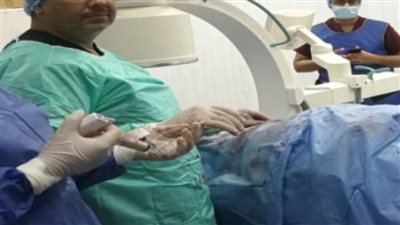 جامعي سوهاج يجري 7 عمليات توسيع للشرايين وتركيب دعامات