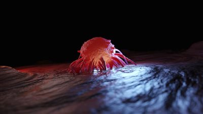 علامة على الوجه تدل على ورم في المعدة