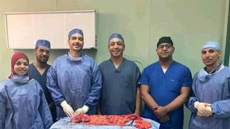 استئصال جذري لورم