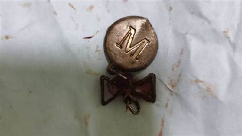 استخراج جسم غريب