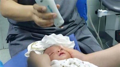 لأول مرة في الصعيد.. تشغيل أحدث كاميرا لتصوير قاع العين وفحص الشبكية بـ