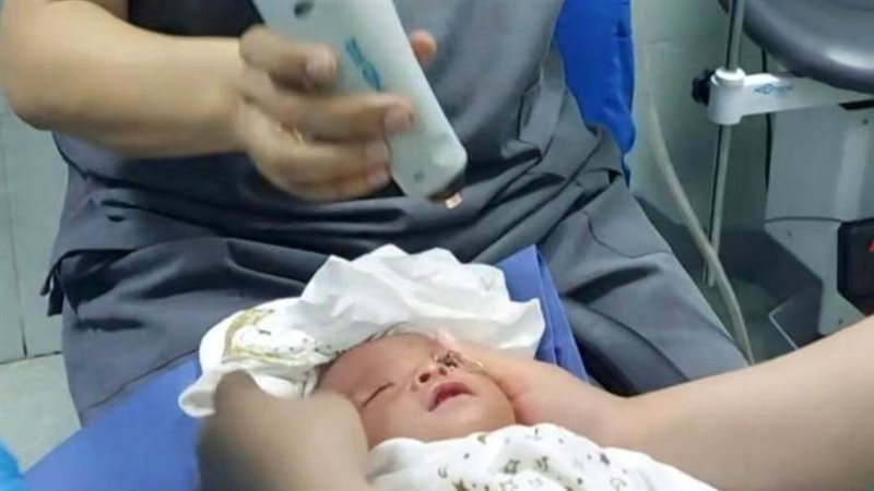 خلال تصوير وفحص عين