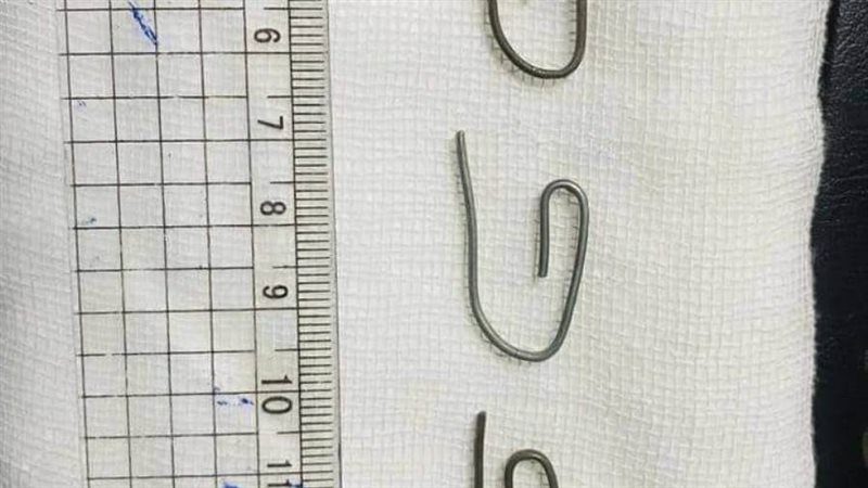 استخراج الدبابيس