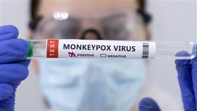 فيتنام تسجل أول إصابة بجدري القرود