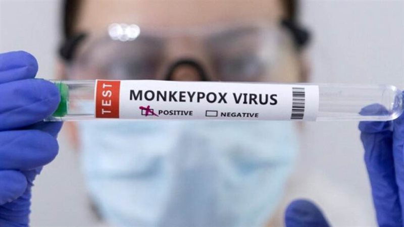 جدري القردة - ارشيفية