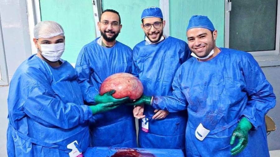 فريق أطباء جراحة الأورام بمستشفى الفيوم العام