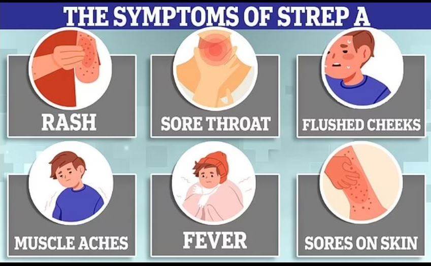 على الرغم من أن بكتيريا Strep A يمكن أن تسبب عددًا من الأمراض الخطيرة، إلا أنها تميل إلى البدء ببعض الأعراض الشائعة، ويشمل ذلك طفح جلدي، والتهاب في الحلق، واحمرار في الخدين، وآلام في العضلات، وحمى شديدة، والتهاب في الأذن، وتقرحات على الجلد