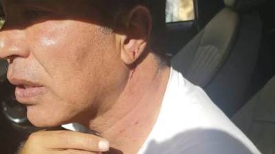 عاجل بالصور| بلطجية يتعدون على أيمن يونس وتحطيم سيارته