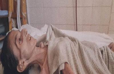 وفاة فلسطينية قادمة من غزة بمستشفى بإيطاليا لإصابتها بسوء تغذية حاد